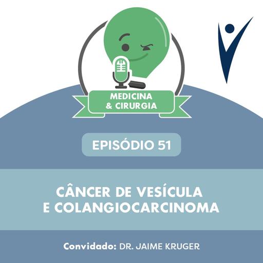 51 - Câncer de vesícula e colangiocarcinoma