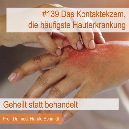 Das Kontaktekzem, die häufigste Hauterkrankung