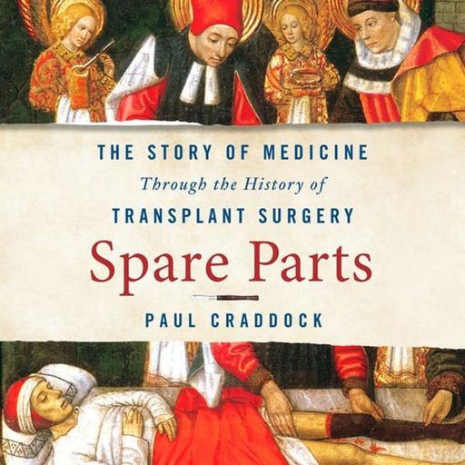 The History of Transplant Surgery