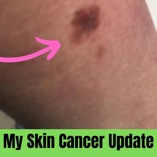 My Skin Cancer latest