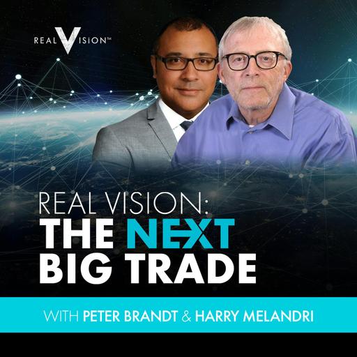 Don't Take Your Eyes Off Gold