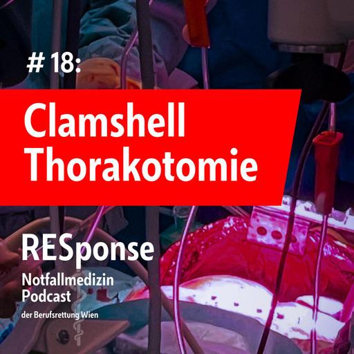 #18: Clamshell Thorakotomie – Maßnahme am Limit?