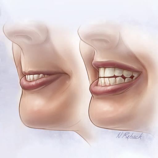 Will This Patient Be Difficult to Intubate? Interview with Dr Michael Detsky