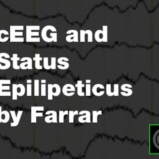 EEG and Status Epilepticus