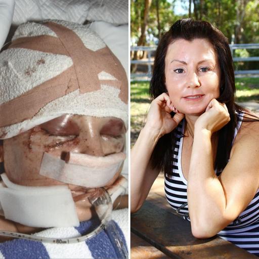 "I was bashed with a baseball bat"