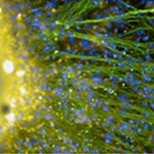 Batalha de neurocientistas #3: Roberto Lent feat. Marília Guimarães sobre o estudo da dor