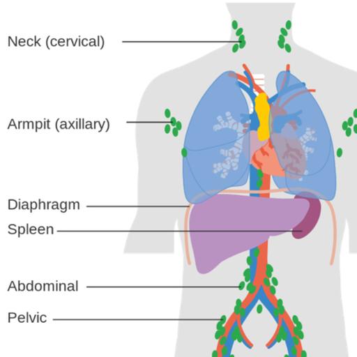 Why do we get achy when sick?