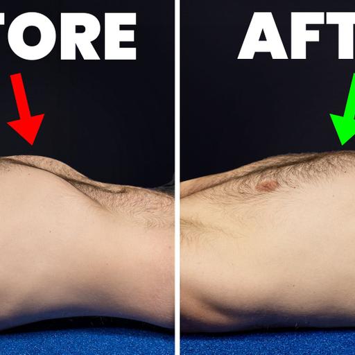 Fix Rib Flare FAST (In Less Than 5 Minutes a Day)