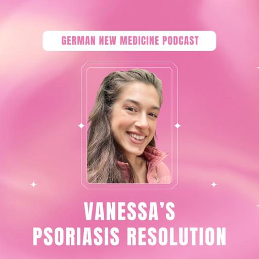 Interview with Vanessa: Psoriasis Resolution