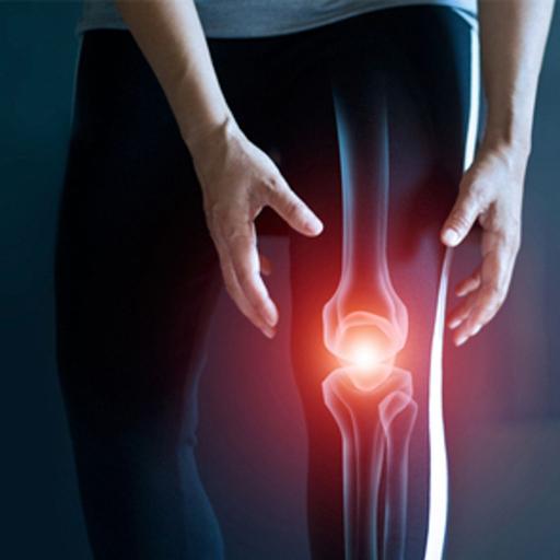 EKU Podcast: Osteoarthritis