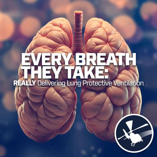 Every Breath They Take: REALLY Delivering Lung Protective Ventilation