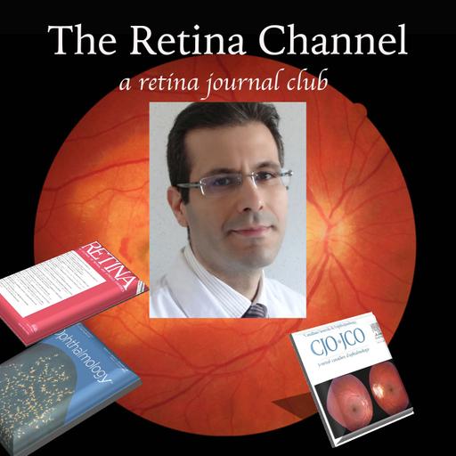 E82-Effect of Perfluorocarbon on Distortion after Repair of Retinal Detachment- Prof. Maher Saleh