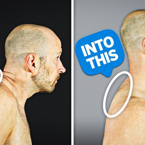 Fix Your Neck Hump FAST (10 Minutes a Day)