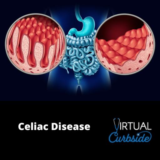 Episode 319: #74-3 Celiac Disease: Treatment
