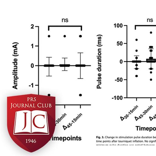 “Effect of Ischemia on Nerve Stimulation” with Brad Hill, MD - Mar. 2025 Journal Club