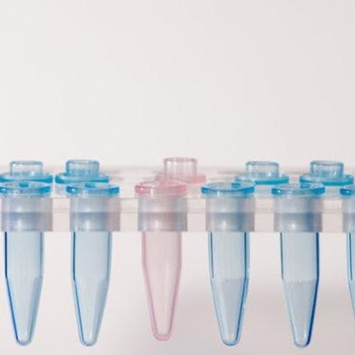 Prenatal Testing and Genetic Counseling