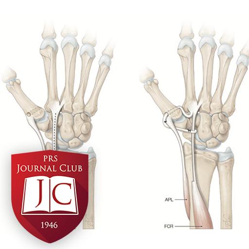 “Eaton-Littler Ligamentoplasty” with Brad Hill, MD - Mar. 2025 Journal Club