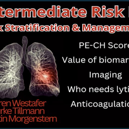 Ep 203 Intermediate Risk Pulmonary Embolism Risk Stratification, Management and Algorithm