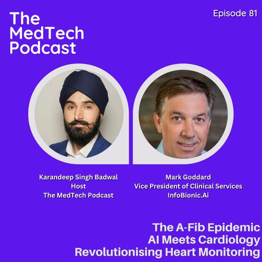 #81 Artificial Intelligence in Cardiology with Mark Goddard: Real-Time ECGs, Home Monitoring and the Atrial Fibrillation Crisis