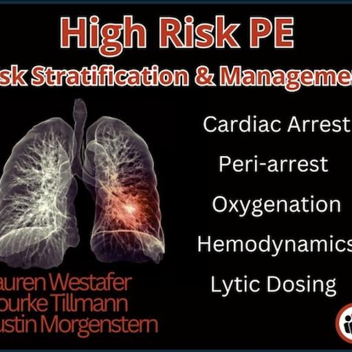 Ep 204 High Risk Pulmonary Embolism Management