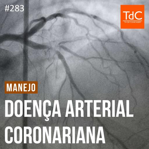 TdC 283: Manejo de doença coronariana crônica