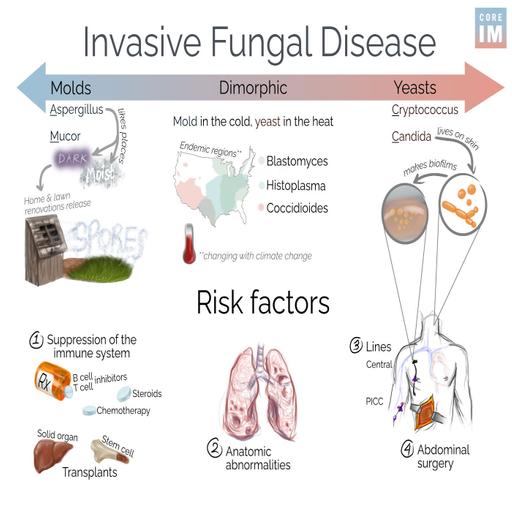 #179 Invasive Fungal Disease: 5 Pearls Segment