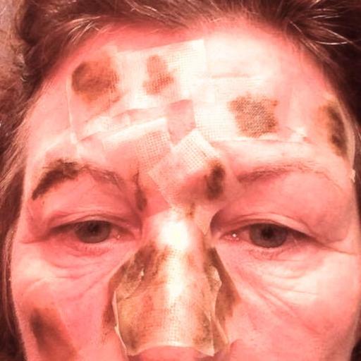 Episode 453: Healing Cancer, Helping Others — Kim Stainton’s Remarkable Journey with Cannabis Oil