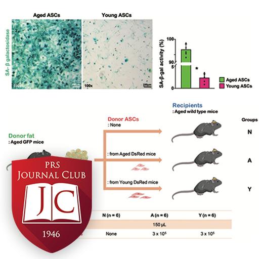 “Young Stromal Cell Effect on Fat Graft” with Chris Campbell, MD - Jun. 2025 Journal Club