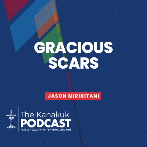 Gracious Scars