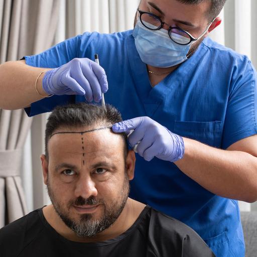 Schluss mit Glatze - Haartransplantationen in der Türkei