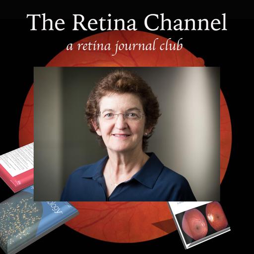 E88- SIRE sign, Geographic Atrophy trials and treatments- Prof. Robyn Guymer