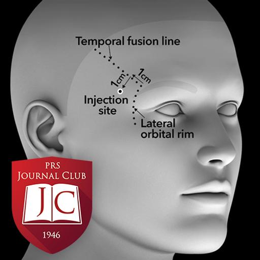 VYC-20L to Correct Temple Hollowing” with Lara Devgan, MD, MPH - Jul. 2025 Journal Club