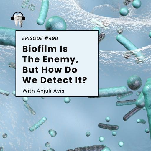 498 Biofilm Is The Enemy, But How Do We Detect It? With Anjuli Avis
