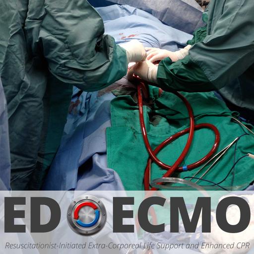 EDECMO 98: Eddy Fan – VV ECMO – Numbers, Nuance, and the Human Factor