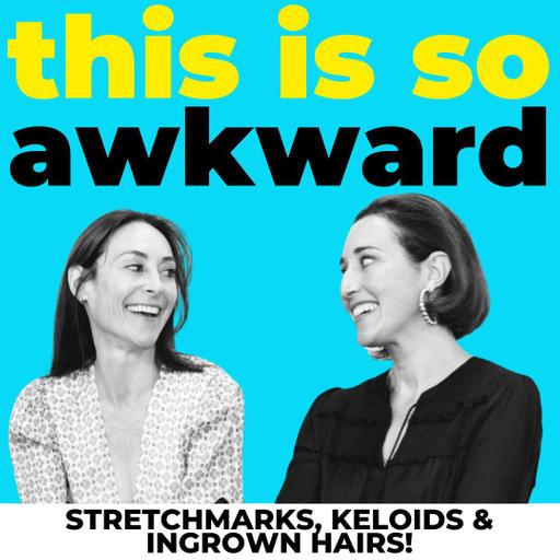 Stretch Marks, Keloids, and Ingrown Hairs!