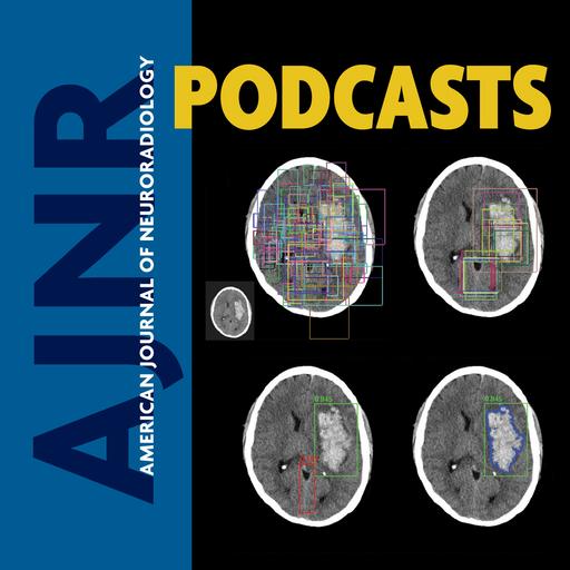 PET in Alzheimer Disease feat. Ana Franceschi