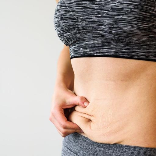 Episode 392: Q+A - How Do I Manage Excess Skin After Weight Loss?