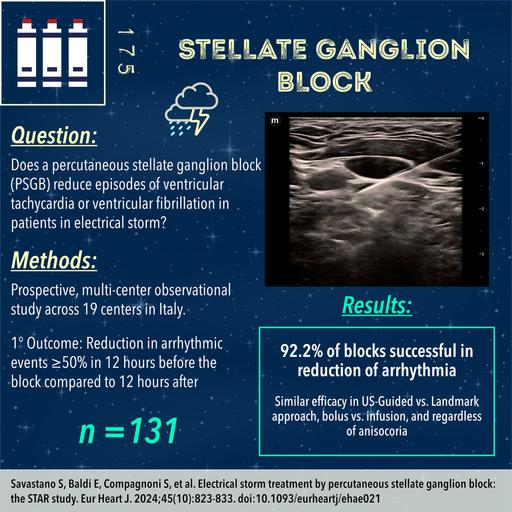 Stellate Ganglion Block