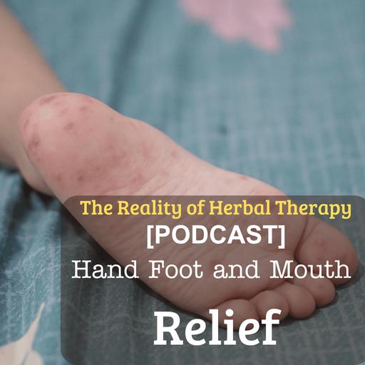 Hand, Foot & Mouth Relief: Herbal Hacks to Soothe Sores Fast