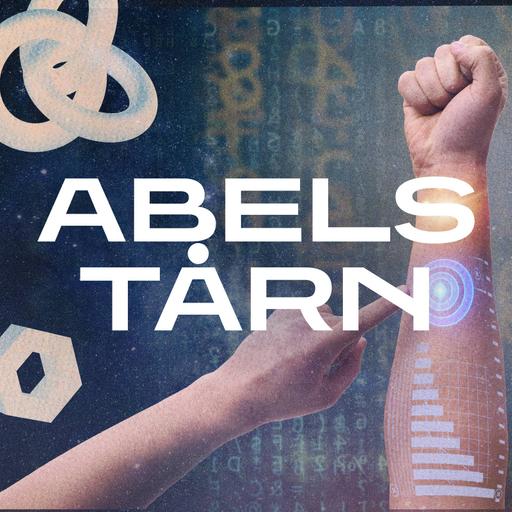 Forskningsfronten - Er vi i ferd med å bli kyborger?