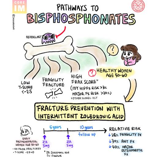 #189 Bisphosphonates and Fracture Prevention Trial: Beyond Journal Club with NEJM Group