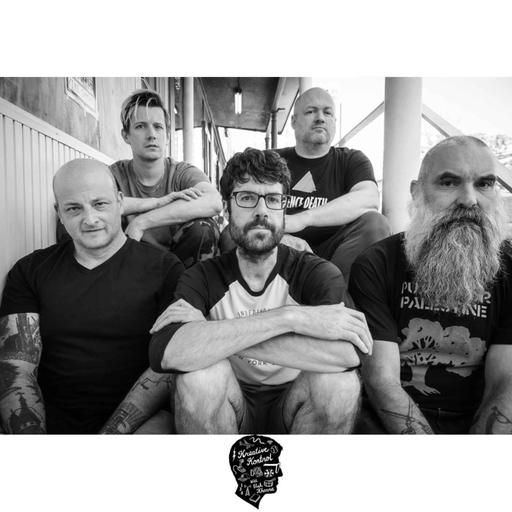 Ep. #1024: Black Eyes