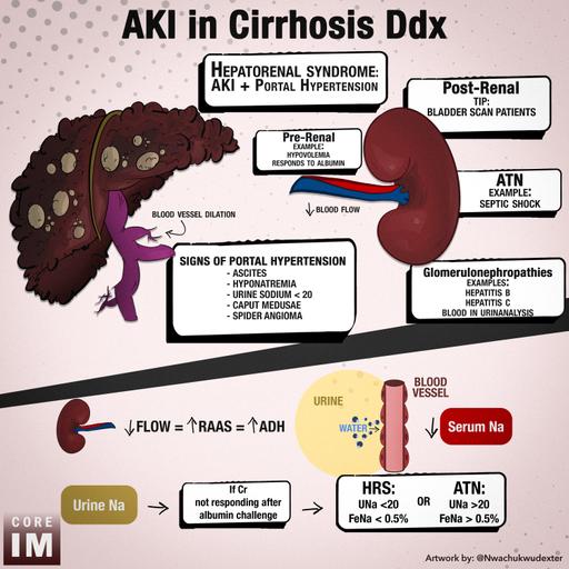 #190: Hepatorenal Syndrome Part 1: 5 Pearls Segment