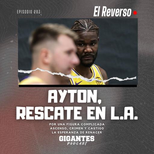 Cap. 283 (Ayton, rescate en L.A.)