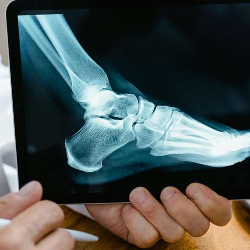 For Better Or Worse, Changes Happen