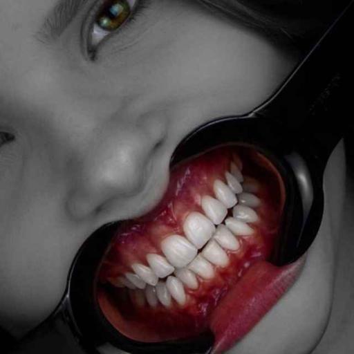 150- Immediate Implants in the Esthetic Zone — Inside the ITI 2023 Consensus