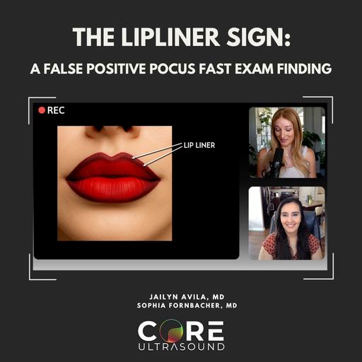 Exploring the Lip Liner Sign: Avoiding False Positives in FAST Examinations