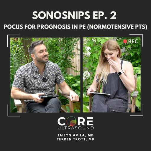 Sonosnips (ICU POCUS) Episode 2! (US in Normotensive PE)