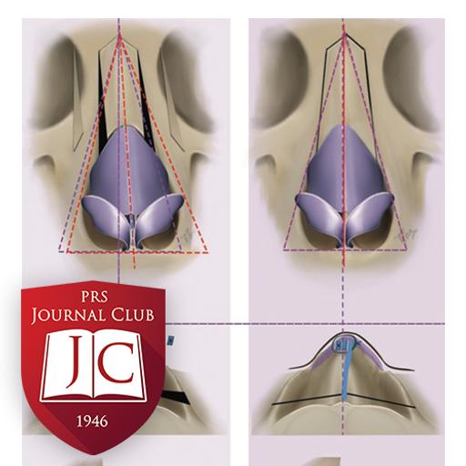 "External Strip and Internal Spreader Graft" with Gabriel Del Corral, MD - Nov. 2025 Journal Club