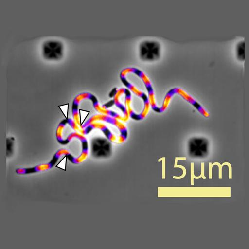 Aparici en Órbita s08e14: La biofísica de los filamentos bacterianos